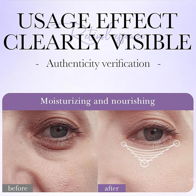 3PCS Retinol Eye Cream for Anti-Aging, Anti-Wrinkle Hydrating Eye Cream with 45% Retinol and 5% Hyaluronic Acid Firming & Repair Dark Circles and Puffiness Reduce Wrinkles and Fine Lines 0.7 oz *3
