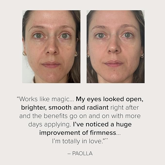 Serovital Beauty Dark Circle Eraser – Brightening & Anti‑Puffiness Under-Eye Treatment with Peptides, Dark Circle Corrector – eye corrector for dark circles - Hormone-Aware, Clinically Tested – 15mL