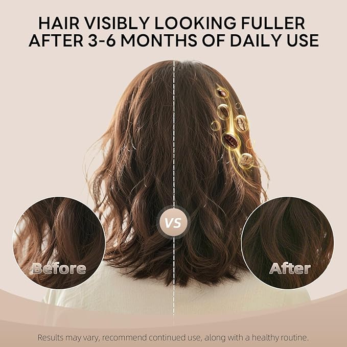 Alfheim Caffeine Shampoo & Conditioner Set | Energizing Hair Care with Biotin & Niacinamide | Strengthens Strands & Supports Scalp Balance | Sulfate-Free, Ideal for Oily Scalp & Fine Hair | 18 oz Each