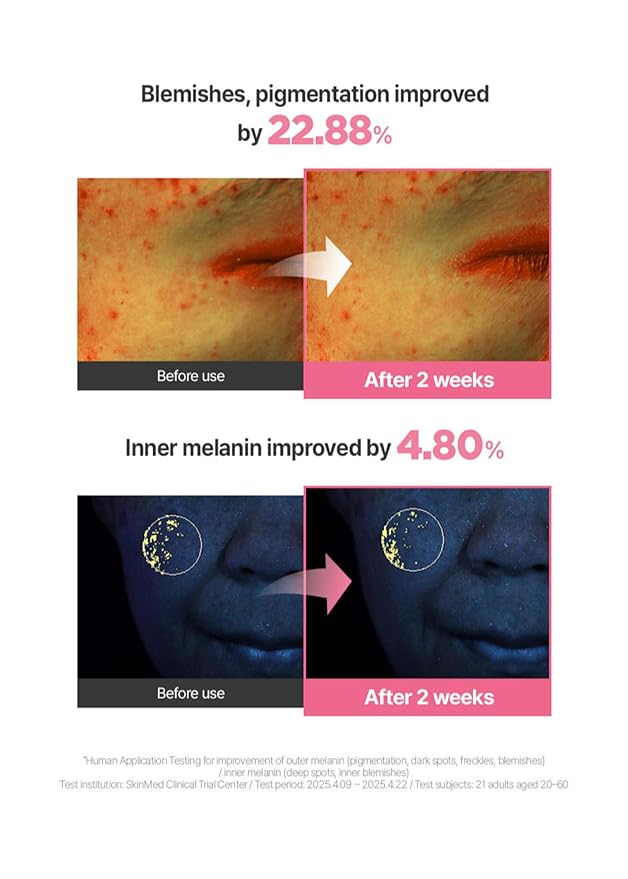 Pink Guava Glutathione Blemish Cream 1.7 Fl Oz, Facial Moisturizer with 99% Pure Glutathione, Niacinamide and Vitamin C, Lightweight Hydration, Korean Skincare for Daily Use