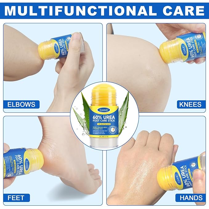 Urea Cream 60 Percent for Feet with 2% Salicylic Acid - Urea Foot Cream for Cracked Heels and Dry Skin, Deep Moisturizing, Callus Remover and Soften - Cracked Heel Repair Cream - Foot Moisturiser 40 g