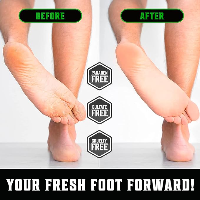 Viking Revolution Tea Tree Foot Cream for Dry Cracked Heels - Foot Balm For Cracked Feet - Dry Feet Repairing Cream with Aloe Vera and Mint (8oz) (Pack of 2)