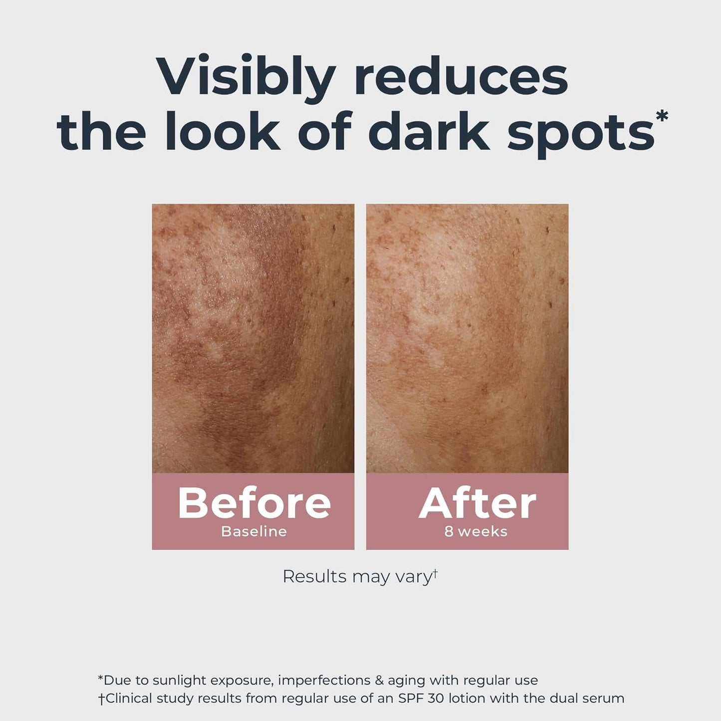 Radiant Tone Dual Serum โ Dark Spot Corrector, 1 oz โจ๐ฟ