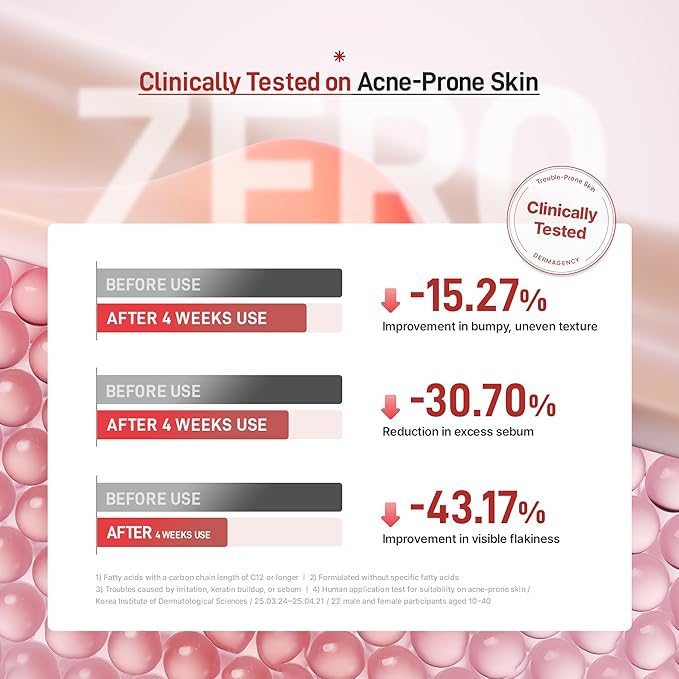 Zeroca 81 Korean Calming Cream for Acne-Prone & Oily Skin – Lightweight Barrier-Repair Moisturizer, Controls Sebum, Deeply Hydrates & Smooths Texture (2.02 fl.oz. 60 ml)