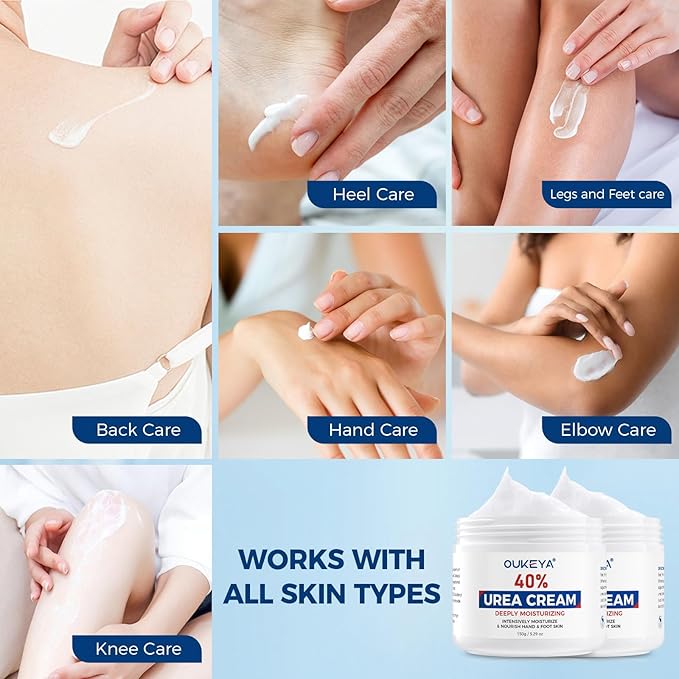OUKEYA Urea Cream,NEW FORMULA Urea Cream 40 percent for Feet Maximum Strength,Dry Cracked Treatment Lotion for Knees & Elbows,Foot Dead Skin Cuticle Callus Remover Toenail Softener,5.29 oz(2 Packs