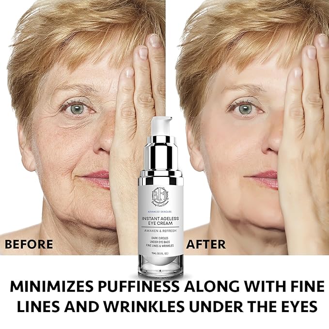 Instant Ageless Eye Cream - Reduces Under Eye Puffiness, Bags, Dark Circles. Lift Technology to Tighten & Firm Sagging Skin Around Eyes. Smooths Away Crow’s Feet, Fine Lines & Wrinkles for Men & Women