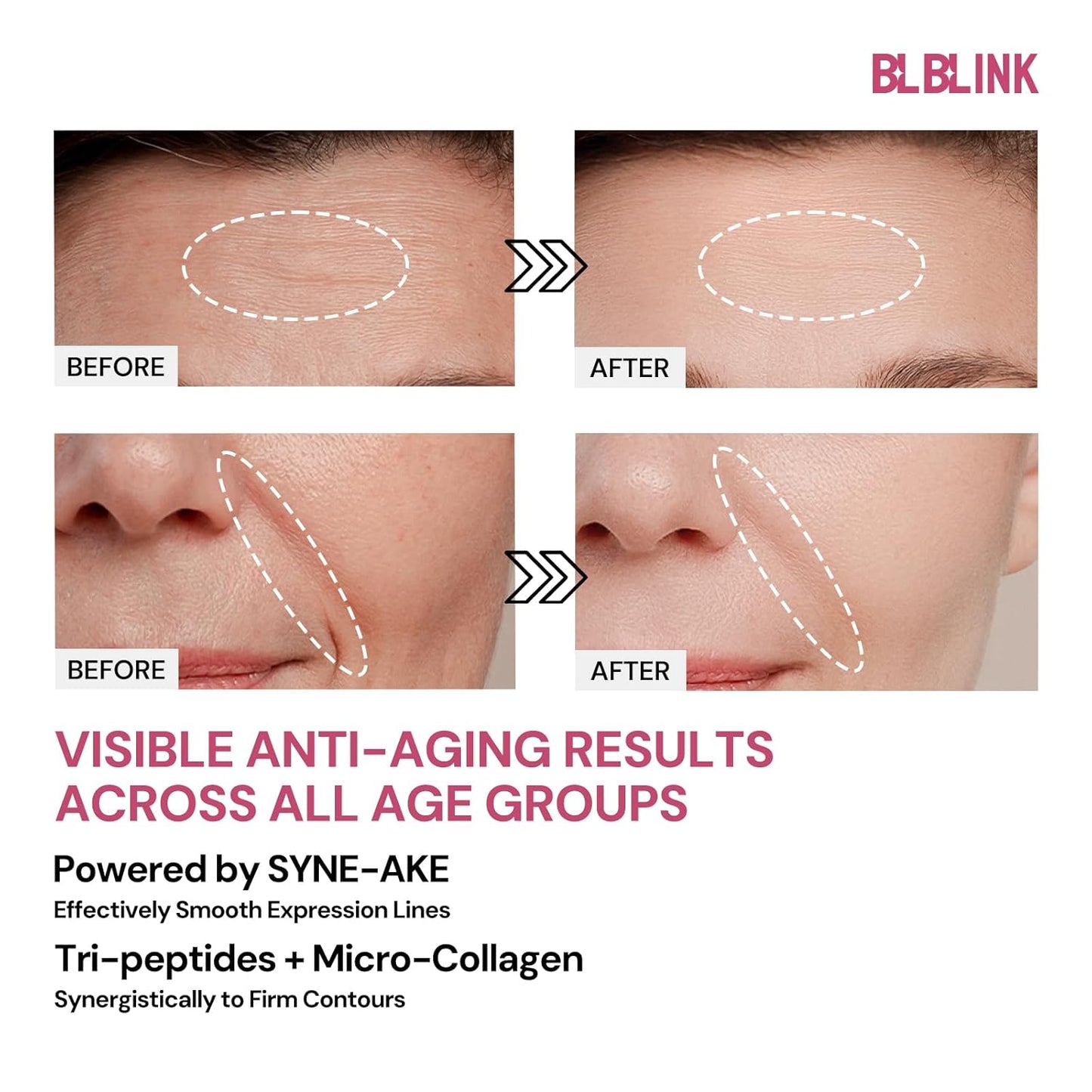 5-Pack Collagen Hydrogel Face Mask β Moisturizing & Firming Overnight Sheet Mask for Dry Skin β Anti-Aging Korean Skincare for Deep Hydration & Wrinkle Repair β 34g x 25ea