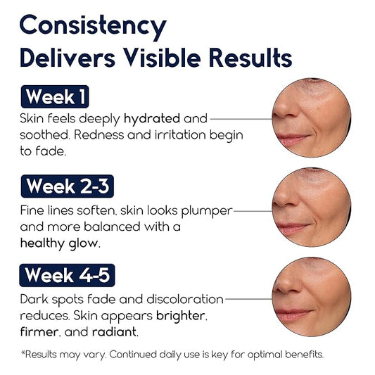 Hyaluronic Acid Serum for Face – 2.5% Hyaluronic Acid + 3% B5 - Acido Hialuronico B5 Serum for Women - Hydrating Formula for Fine Lines, Wrinkles & Anti Aging - 30ml