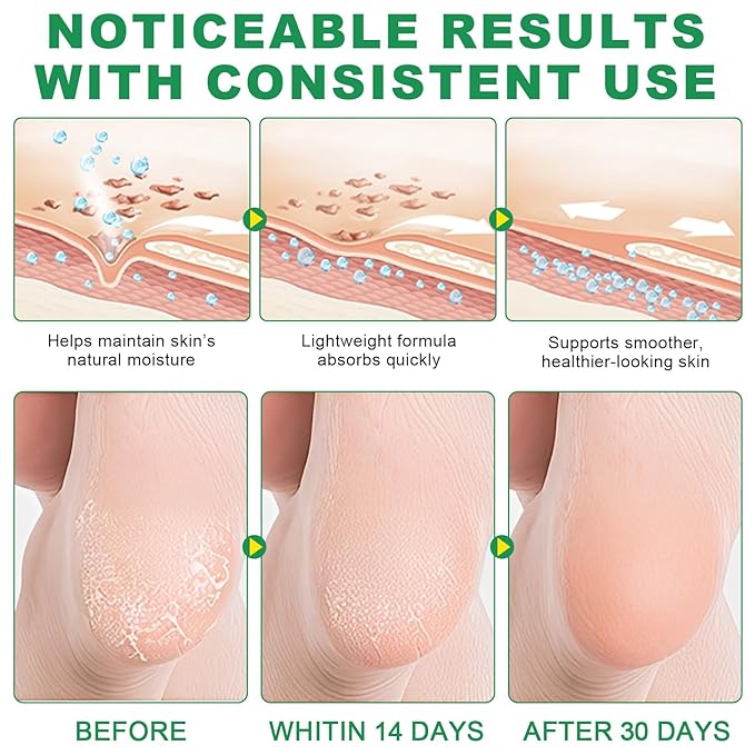 60% Urea Cream plus 2% Salicylic Acid, Cracked Heel Repair Balm Stick for Dry Cracked Feet Treatment,Foot Hand Cream Stick for Smoothing Hands Elbows Feet Knees,Moisturizes and Hydrates the Dry Skin