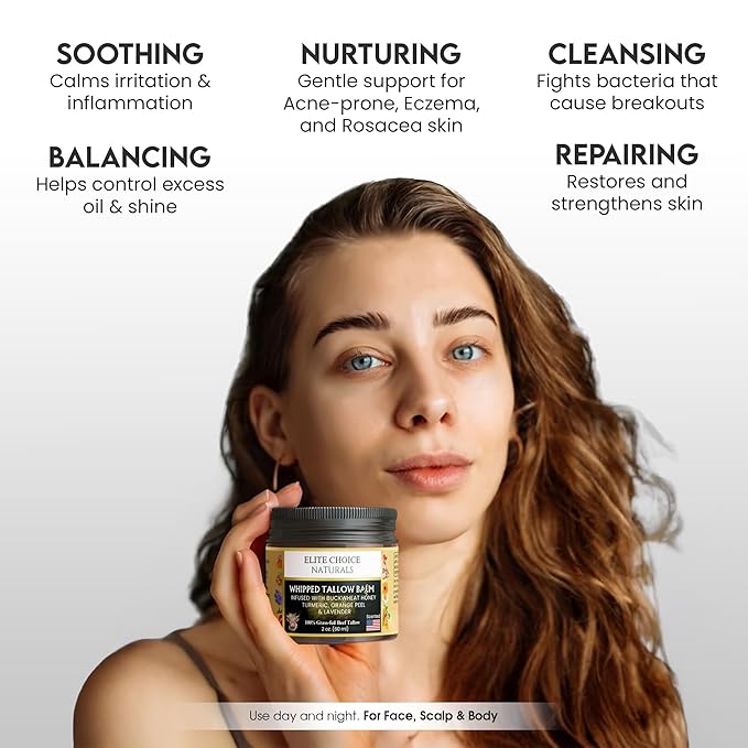 Whipped Tallow Balm Infused with Raw Buckwheat Honey, Lavender & Orange – Organic Anti-Inflammatory Cream for Face, Scalp & Body – Heals Sensitive, Acne-Prone, Eczema, Rosacea & Psoriasis Skin (2 oz)