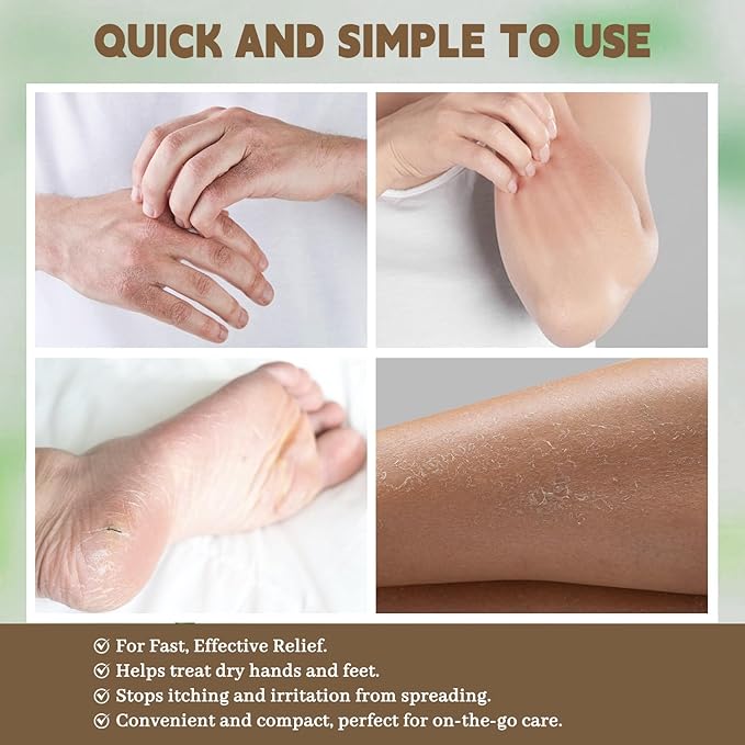 Urea Cream 60% for Feet, Maximum Strength Professional Cracked Heel Repair Balm Stick for Dry Foot Hand, Heals and Moisturizes for Healthy Feet with Tea Tree Oil, Aloe Vera and Rosemary 1.41 oz