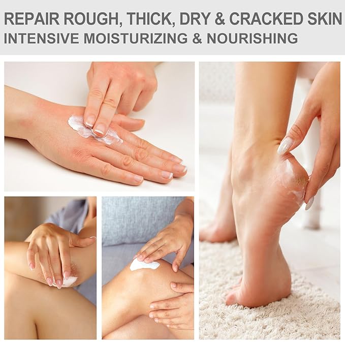 2 Packs Urea Cream 40 Percent - Foot & Hand Cream, for Dry, Cracked Heels, Feet, Knees, Elbows, and Hands, Callus Remover, Maximum Strength Urea Lotion for Softening and Moisturizing