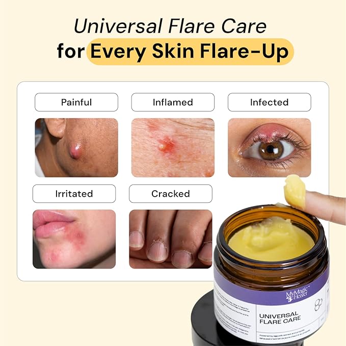 Universal Flare Care | Drawing Salve for HS, Boils, Cysts, Hemorrhoids, Pilonidal Cyst, Abscess | Anti-Chafing, Wound Care, Relief for Itching Skin w/Propolis & Egg Yolk Extract 4 oz