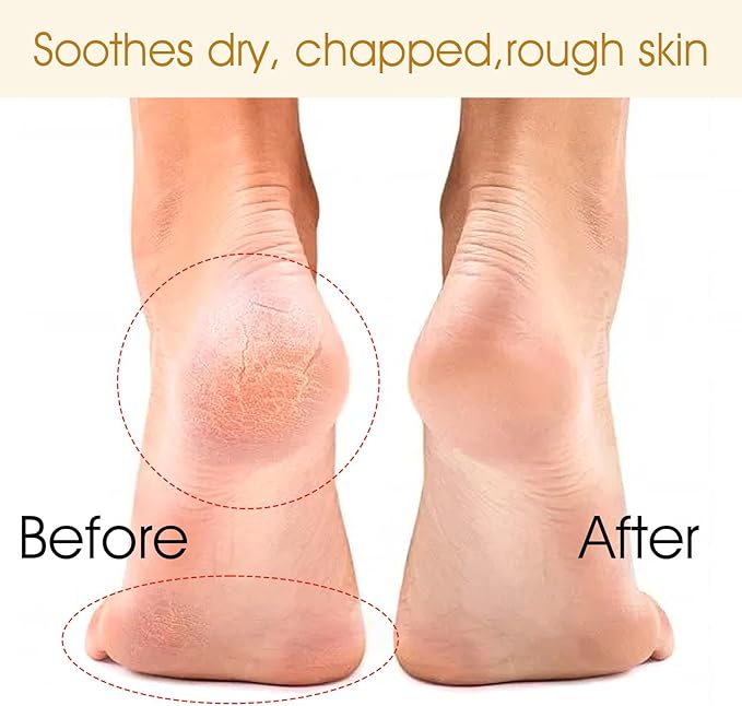 Cracked Heel Repair Socks - 6Pairs Moisturizing Heel Socks for Cracked Heels Moisturizer Spa Sock for Dry Cracked's Feet Overnight, Foot Care Lotion Sock for Women (US Szie 7-9)