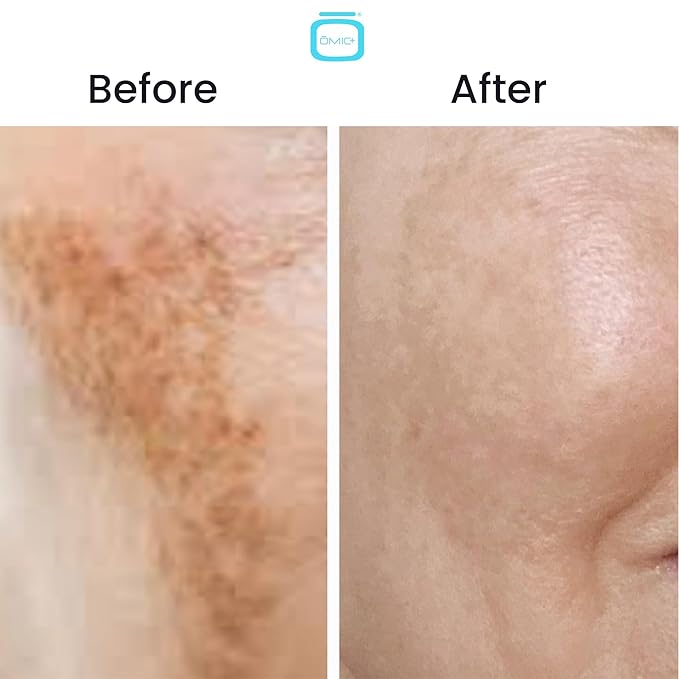 OMIC 10% Tranexamic Acid Cream – 1 fl oz / 30ml – Skin Brightening Cream, Reduce Appearance of Dark Spots, Skin Moisturizer, Even Skin Tone with Coconut Oil & Vitamin E