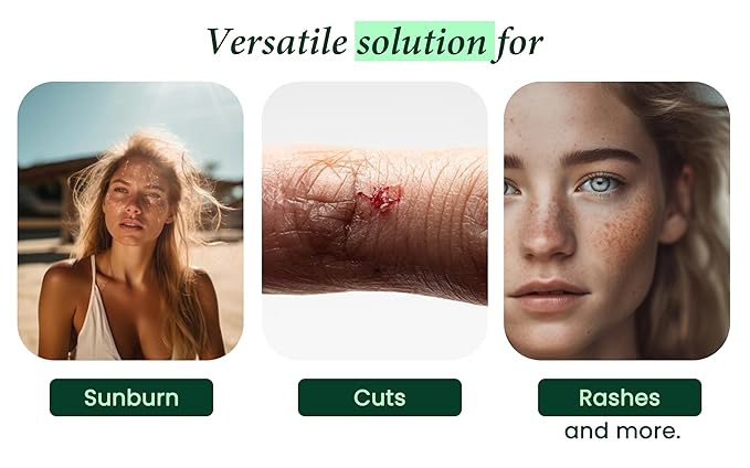 99.75% Pure & Organic Aloe Vera Spray, Clinically tested & Dermatologist approved, Hydrates & Heals Dry & Damaged Skin & Hair- 12 Oz