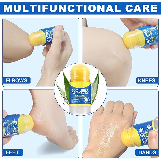 60% Urea Foot Cream with 2% Salicylic Acid, Foot Cream Moisturizer for Dry Cracked Feet, Knees, Elbows, Hands, Moisturizes and Hydrates the Dry Skin, Skin Softener, 1.41oz