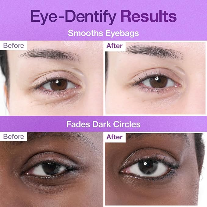 numbuzin No.9 Eye Patches | NAD+ Collagen Under Eye Patches | Dark Circles, Cooling, Puffy Eyes, Eyebags, Wrinkles | Peptides, Caffeine, Niacinamide | Self Care, Gift | 5 Pairs, 10 Patches
