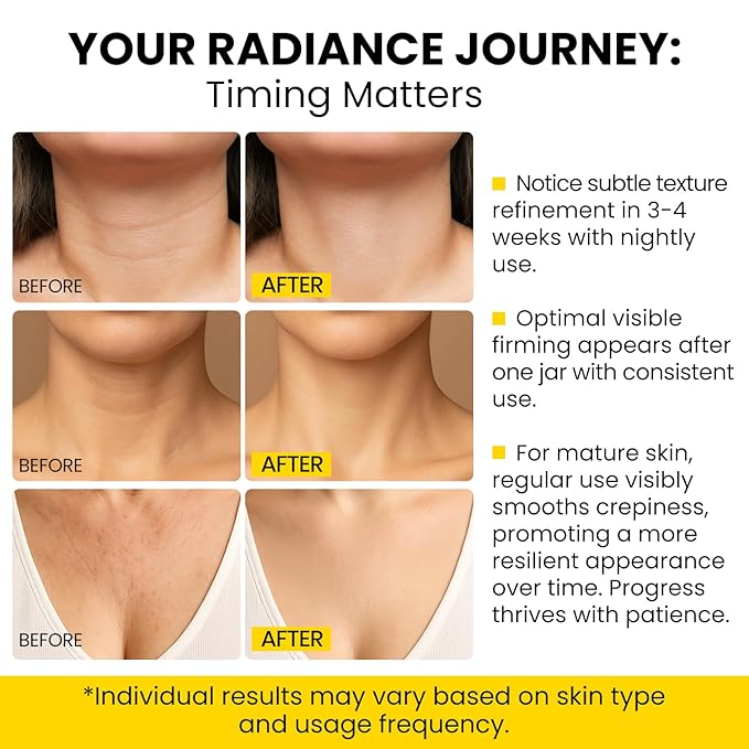 8-in-1 Radiant Neck Firming Cream, Tighten and Lift Neck Wrinkle Cream, Collagen Retinol Face and Chest Firming Tightening for Women and Men with Sagging Crepey Skin Over 50 & 60