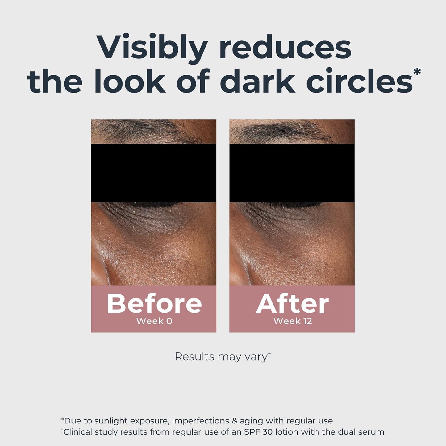 Radiant Tone Eye Cream β Dark Circle Corrector, 0.5 oz ποΈβ¨