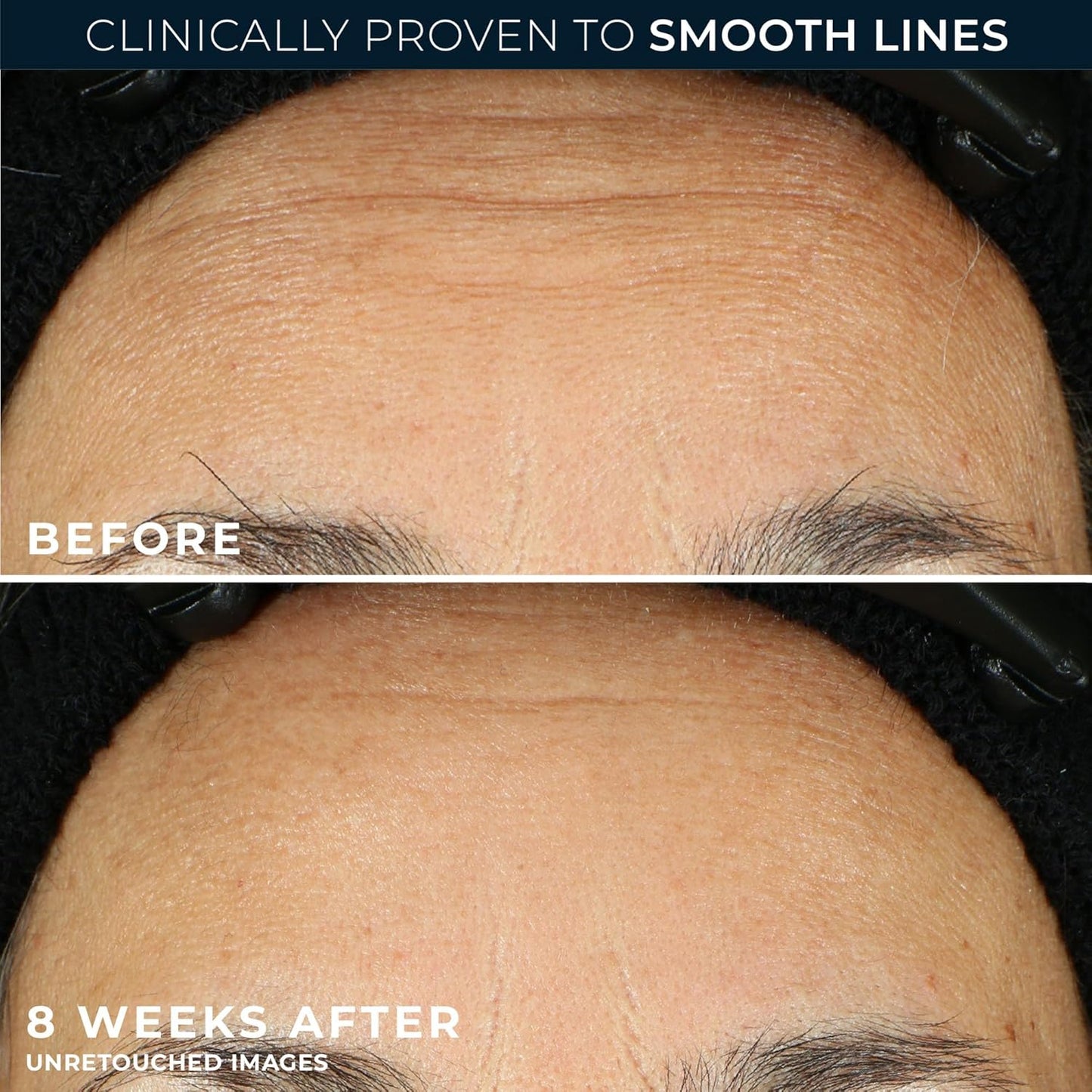 π Retinol Night Serum for Wrinkles β 30 Capsules | Anti-Aging, Line Smoothing, Post-Acne Care, Fragrance-Free
