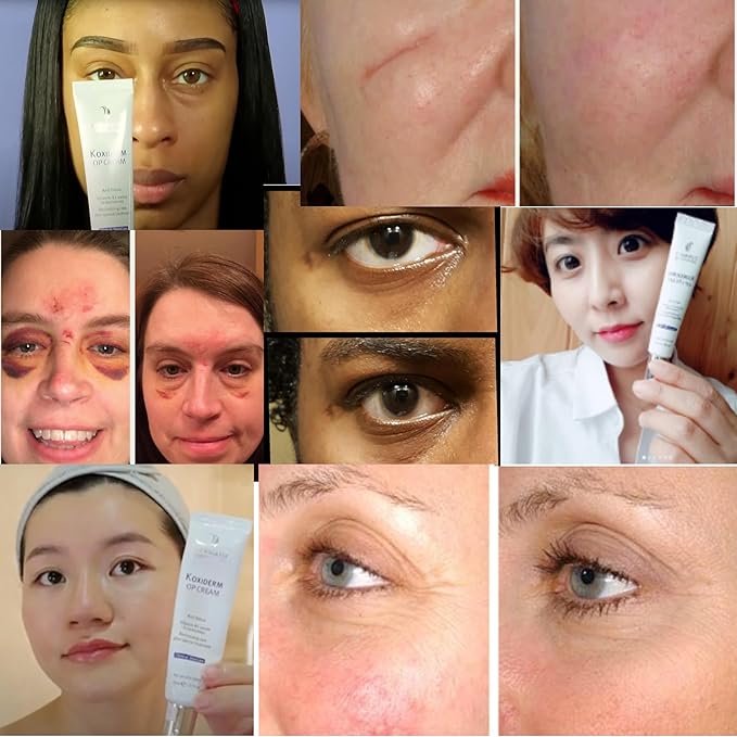 Vitamin K1 Oxiderm Cream Minimizing Appearance of Old and New Scars, Dark Eye Circles, Bruises, Varicose Veins, Purpura and Redness 1.01Oz