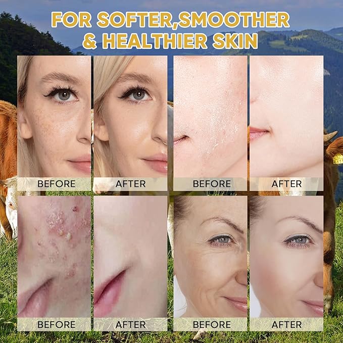 Beef Tallow for Skin, Organic Grass-Fed Beef Tallow Balm,Tallow and Honey Balm with Raw Honey, Olive Oil - Body & Face Moisturizer, Soothes and nourishes for Dry & Sensitive Skin