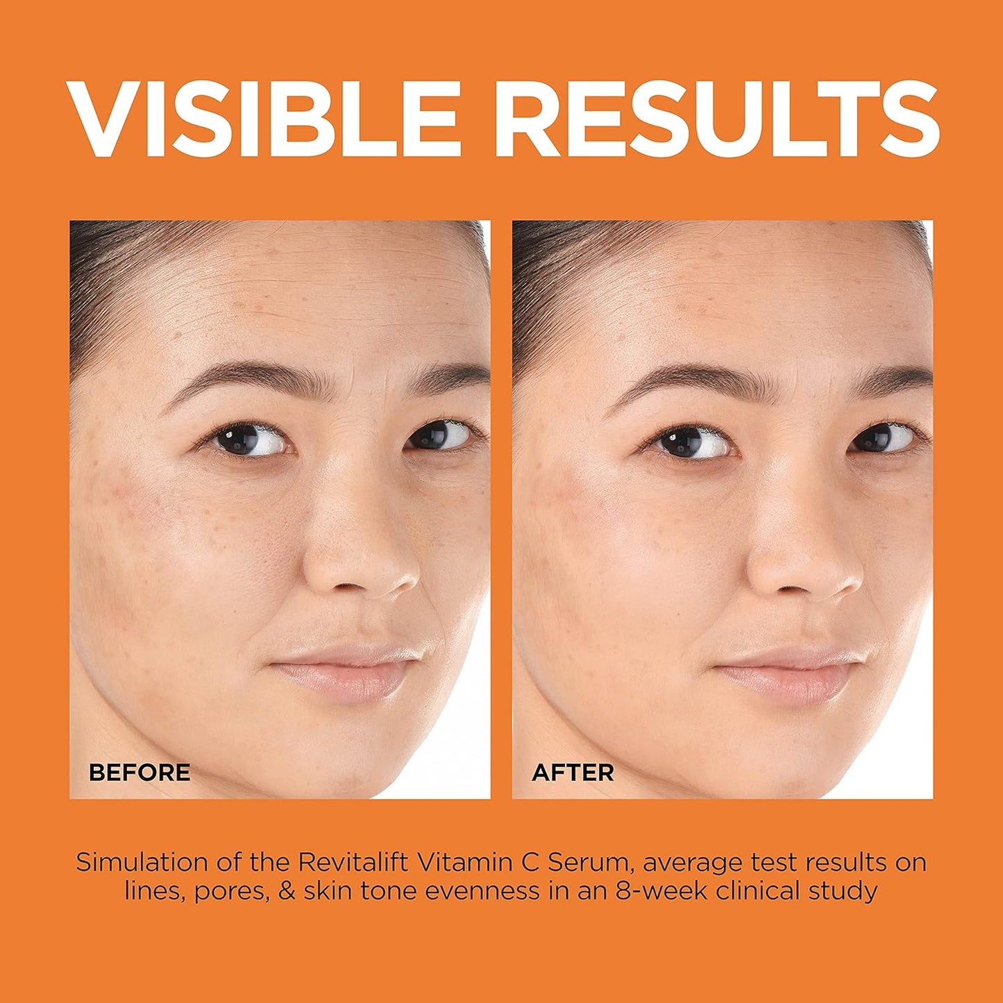 Revitalift 12% Pure Vitamin C Serum β Brightening Serum + Moisturizer Sample β¨π