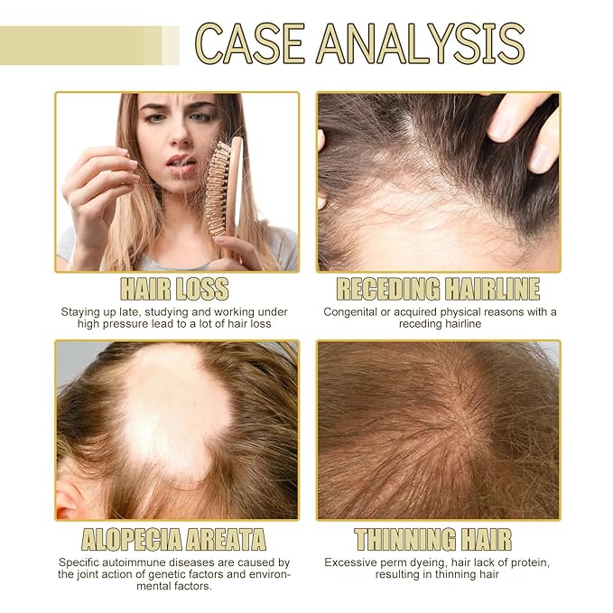 60 ML Eelhoe Natural Hair Growth Oil, HuaQing Natural Hair Growth Organic Rosemary Oil for Dry Damaged Hair and Growth Thin Hair.