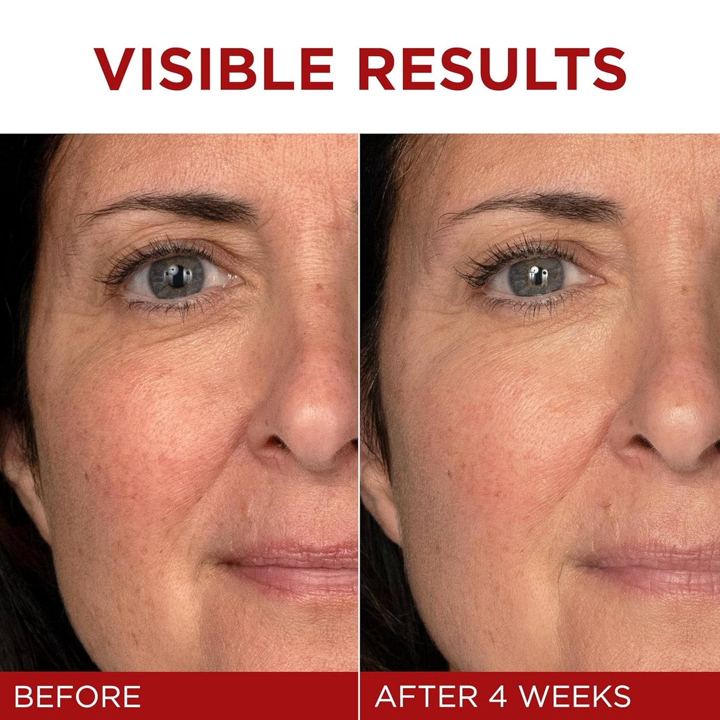 Anti-Aging Face Cream with Retinol, Vitamin C & Hyaluronic Acid β Wrinkle Repair Moisturizer for Mature Skin π§β¨ | Revitalift Triple Power Lifting Cream, 1.7 Oz