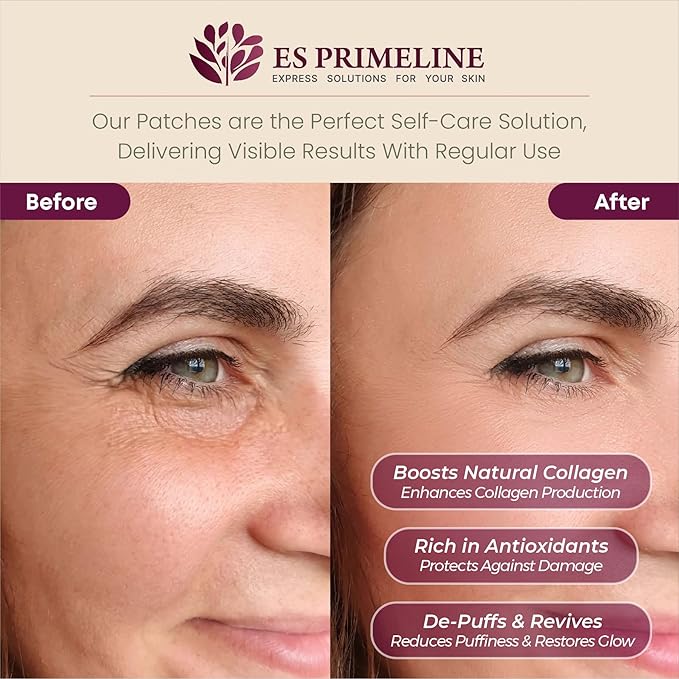 Bio Cellulose Under Eye Patches for Puffy Eyes & Dark Circles Natural Eye Masks Anti Wrinkles &Eye Bags Soothing Skincare Treatment for Woman & Men 12pairs- Parches Para Ojeras |10ml Serum Gift