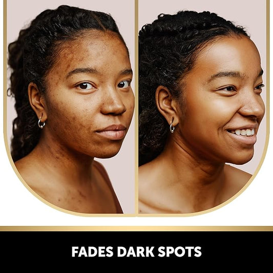 VALITIC 2 Pack Kojic Acid Vitamin C & Retinol Soap Bars for Dark Spot & A Pair Of Black Exfoliating Gloves for Body Scrubs