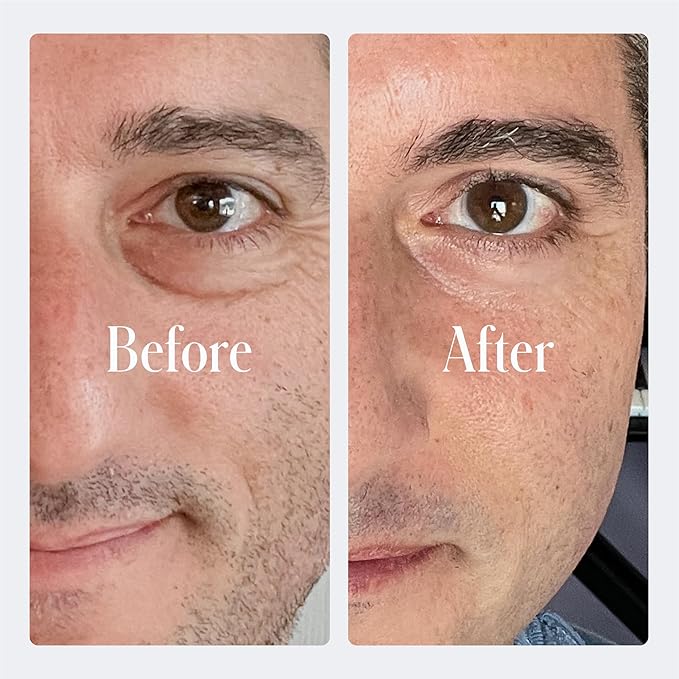 Geologie Dark Circle Under Eye Cream | Formulated to Help Dark Circles, Puffy Eyes Fine Lines & Wrinkles | Kojic Acid, Caffeine, Peptides, Niacinamide & Hyaluronic Acid