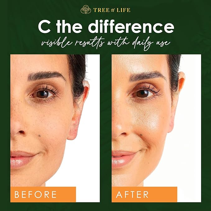 Tree of Life Beauty Vitamin C Skin Care Set, Skin Brightening Face Oil for Dark and Age Spot, Facial Serums for Dry and Sensitive Skin with Hyaluronic Acid & Vitamin E Soft Skin, 1 Fl Oz (Pack of 2)