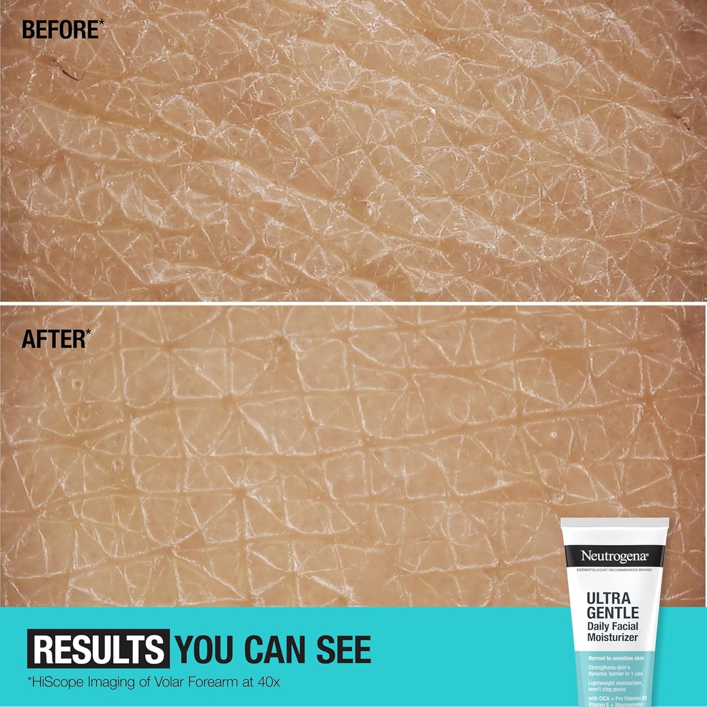 Fragrance-Free Facial Moisturizer for Sensitive Skin โ 3.4 oz ๐ฟ๐ง