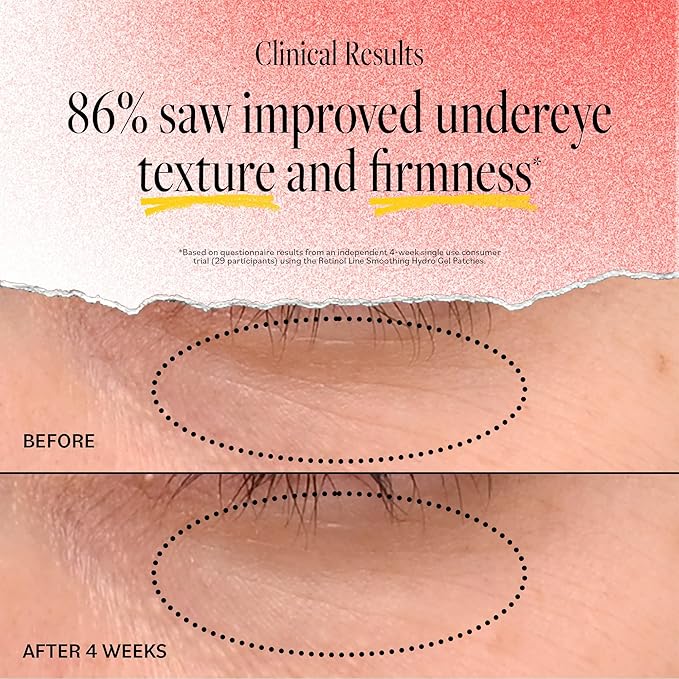 DERMA E Retinol + Bakuchiol Under Eye Patches (5 Pairs) Non-Irritating, Line Smoothing Hydro Gel Eye Patches with Rose Water & Real Hibiscus Petals, Helps Reduce Fine Lines, Crows Feet & Wrinkles,10Ct