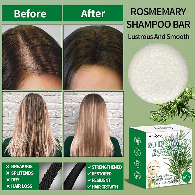 2 Pack Rosemary Oil Shampoo Bar,Natural Solid Hair Growth Soap Bars,Effective Cleansing Scalp Hair Loss Shampoo Bar,Organic Hair Oil Control,Strengthening,Thickening & Volumizing Soap for Hair