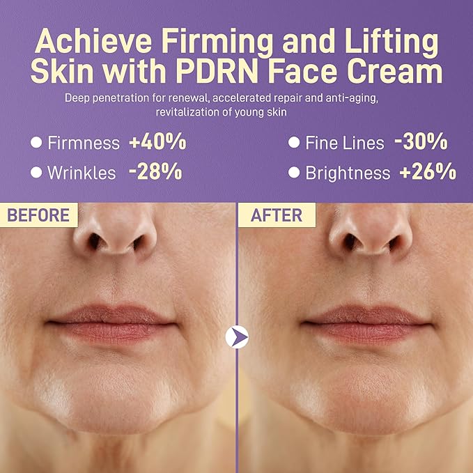 Anti-Aging Repair Face & Neck Cream, 10,000ppm PDRN Salmon DNA, 50,000ppm Pure Planted-Advanced Squalane, NAD+, Retinol & Collagen, Firming, Hydrating, Soothing Repair for All Skin Types,1.85 Fl Oz
