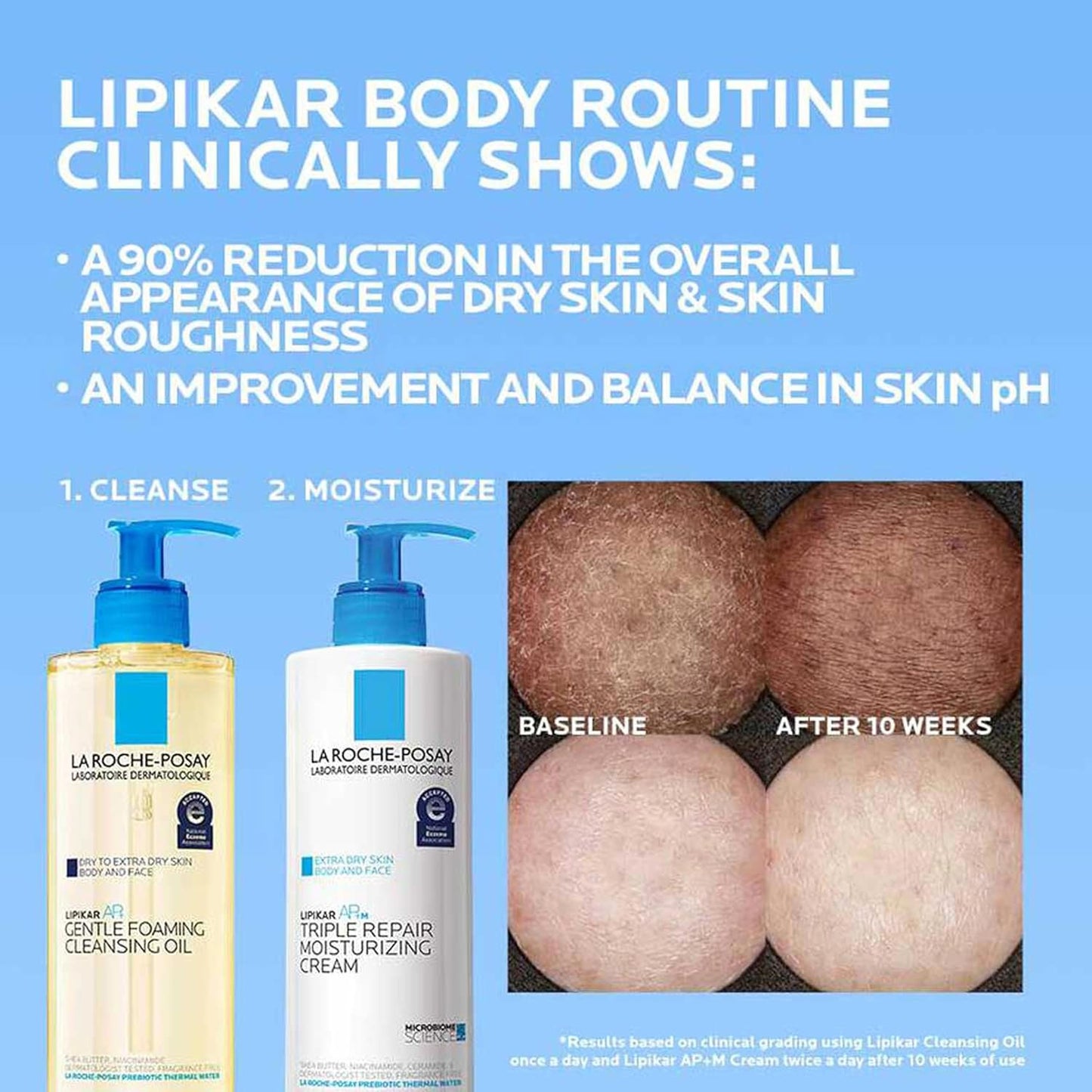 π§ La Roche-Posay Lipikar AP+ Triple Repair Moisturizing Cream β Face & Body Lotion for Dry, Sensitive Skin with Shea Butter & Niacinamide