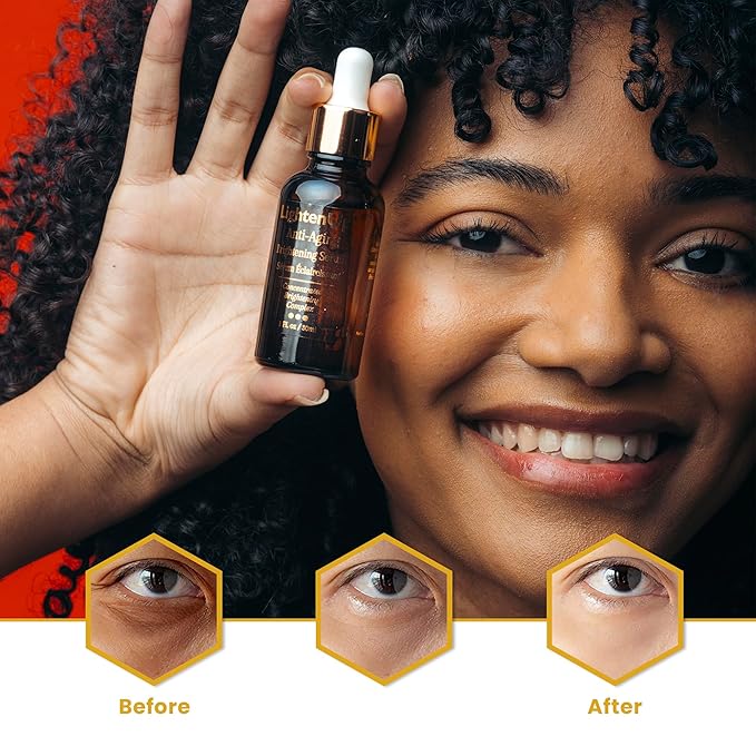 OMIC Lighten-Up Skin brightening Serum, 1 Fl oz / 30 ml, for Face, Armpits, Hands, Knees and Body, with Argan Oil and Shea Butter