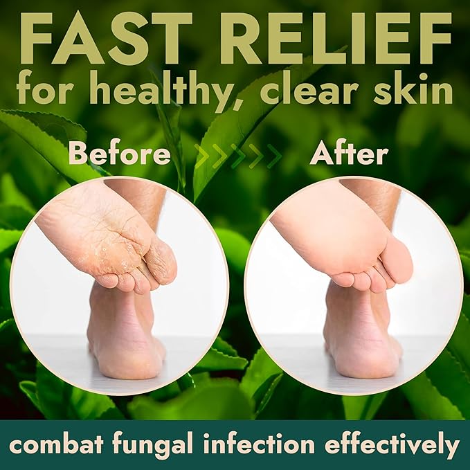 Foot Scrub with Tea Tree Oil | Callus Remover For Feet | Exfoliating Scrub with Salicylic and Glycolic Acid for Dead Skin, Athleteβs Foot, Warts, Corns, Rashes, Foot Odor, Insect Bites and Foot Care