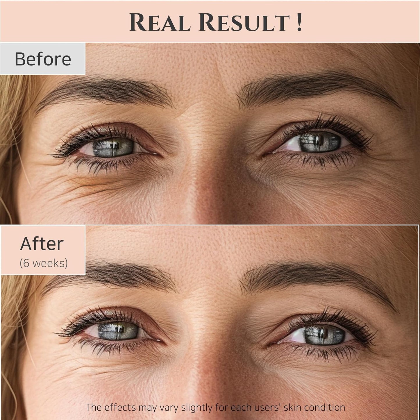 ✨ Revive Retinal Eye Serum – Korean Anti-Aging Eye Treatment for Dark Circles & Puffiness (30ml)