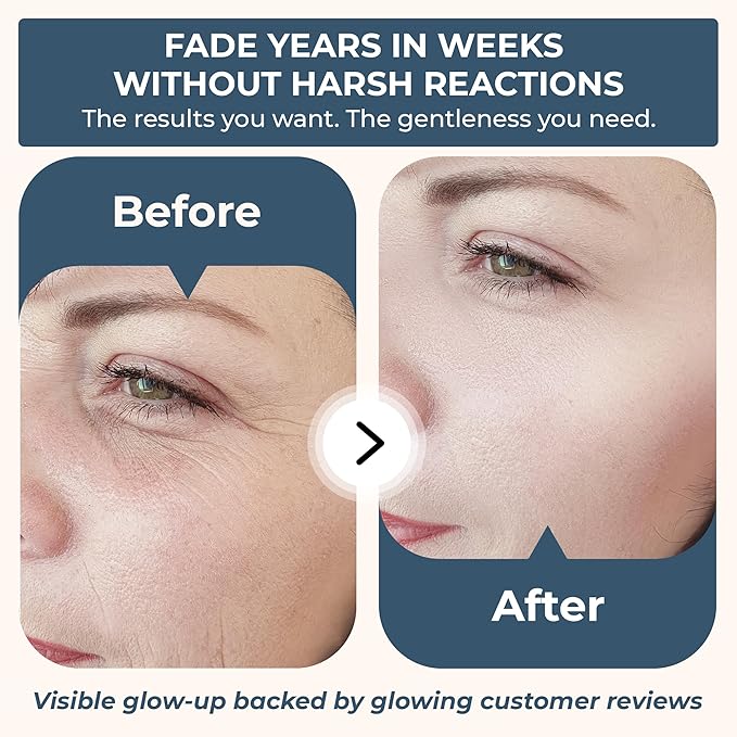 Vรฉraglo Retinol Skin Booster Serum & Hydrating Moisturizer Face Cream Set โ Anti Aging Serum and Moisturizer with Hyaluronic Acid & Collagen for Wrinkles, Fine Lines & Dark Circles
