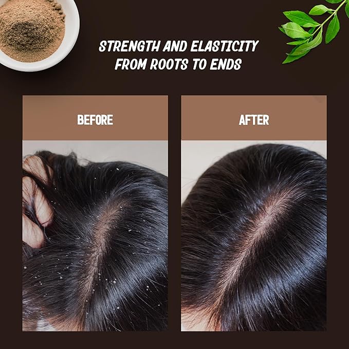 Scalp Scrub & Cleanser – Perfect Exfoliating Scalp Care - Best for Hair Care & Hair Growth - Instant Relief for Irritated Scalps – Restorating Ayurvedic Hair Treatment - 6.7 oz