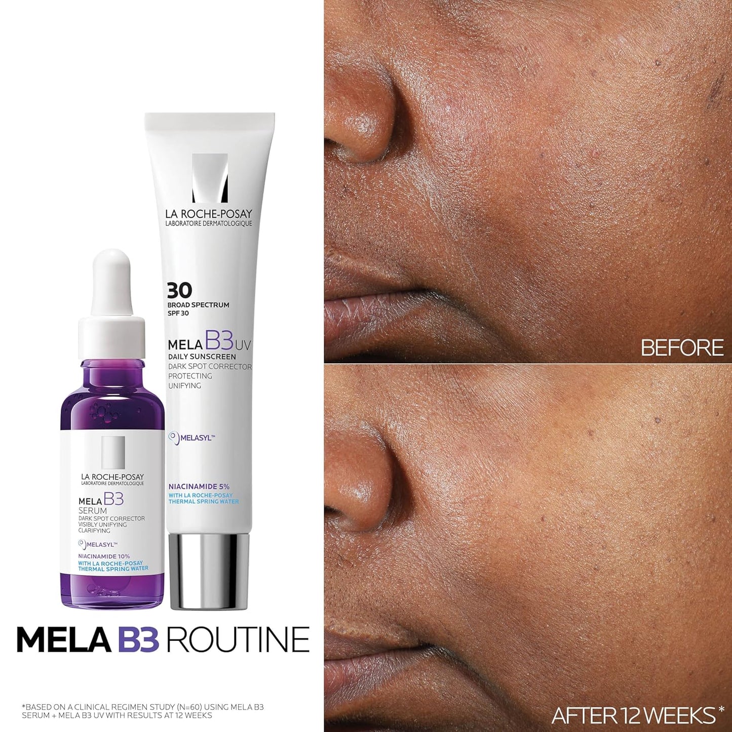 La Roche-Posay Mela B3 Dark Spot Corrector Serum with 10% Niacinamide