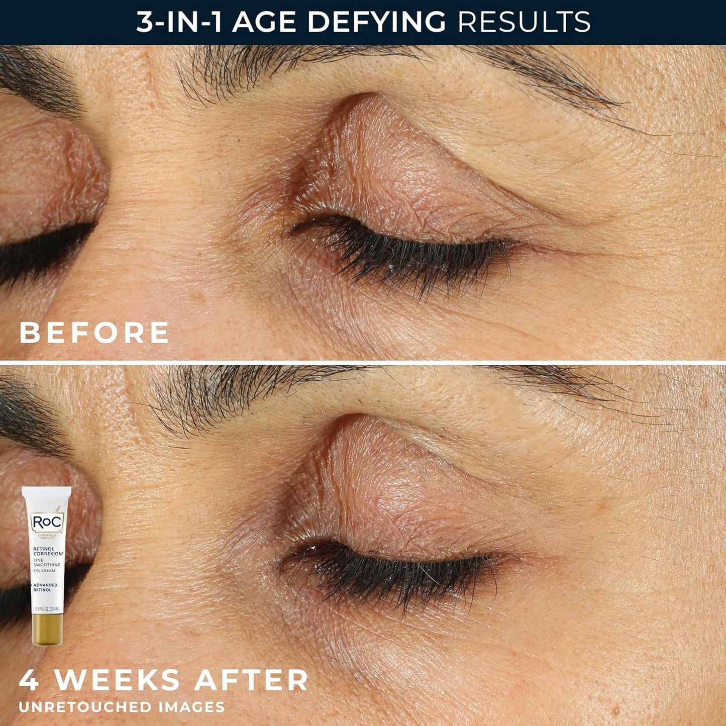 Retinol Correxion Anti-Aging Skincare Duo – Deep Wrinkle Night Face Cream + Under Eye Cream for Dark Circles & Puffiness | Retinol Value Set for Mature Skin (Packaging May Vary)