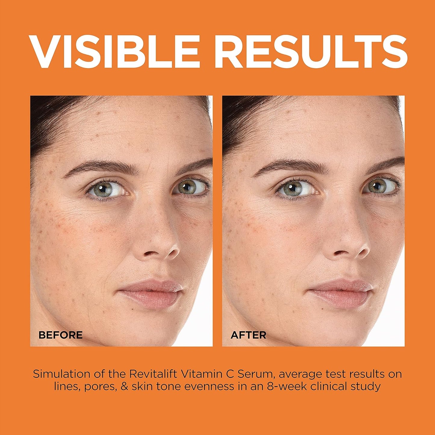 Revitalift 12% Pure Vitamin C Serum β Brightening Serum + Moisturizer Sample β¨π