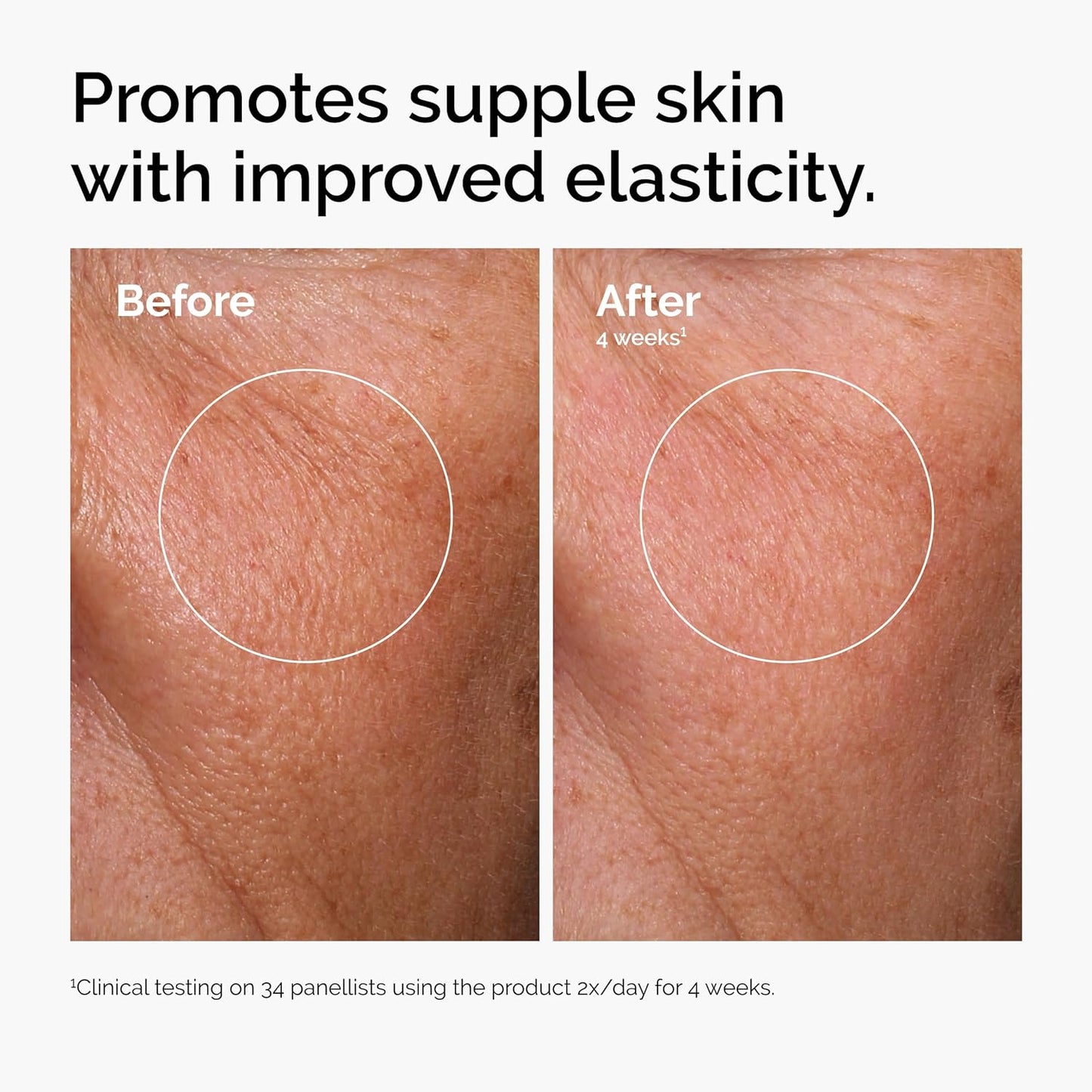 ✨ The Ordinary Skincare Power Trio