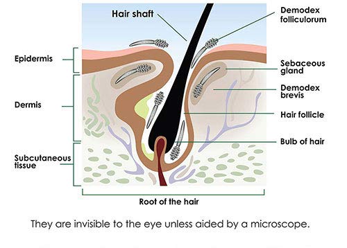 Ungex Demodex Defence Cleanser | Face, Scalp and Body Wash | Herbal Based | DDC