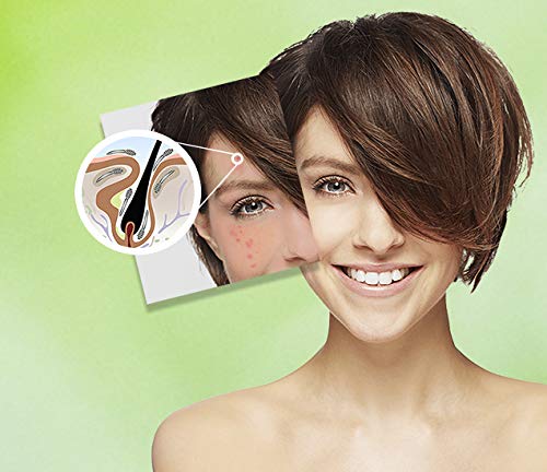 Ungex Demodex Defence Cleanser | Face, Scalp and Body Wash | Herbal Based | DDC